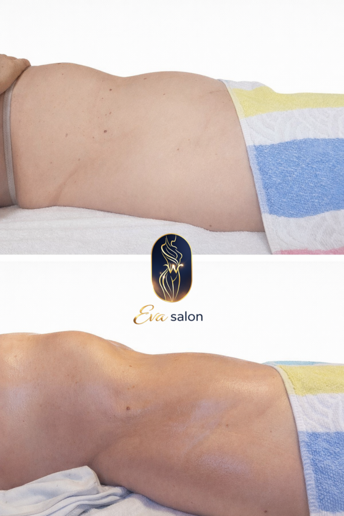 Ukázka proměny těla po manuální péči v Eva Salon